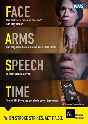 F.A.S.T - when stroke strikes, act fast (A4 poster)